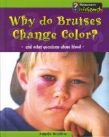 Why_Do_Bruises_Change_Color_